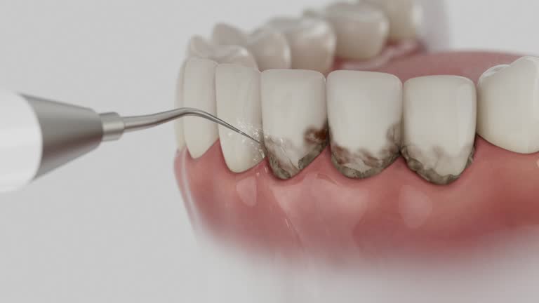 Reliable Dental contractor in Wellington, OH by Dentist Open Now